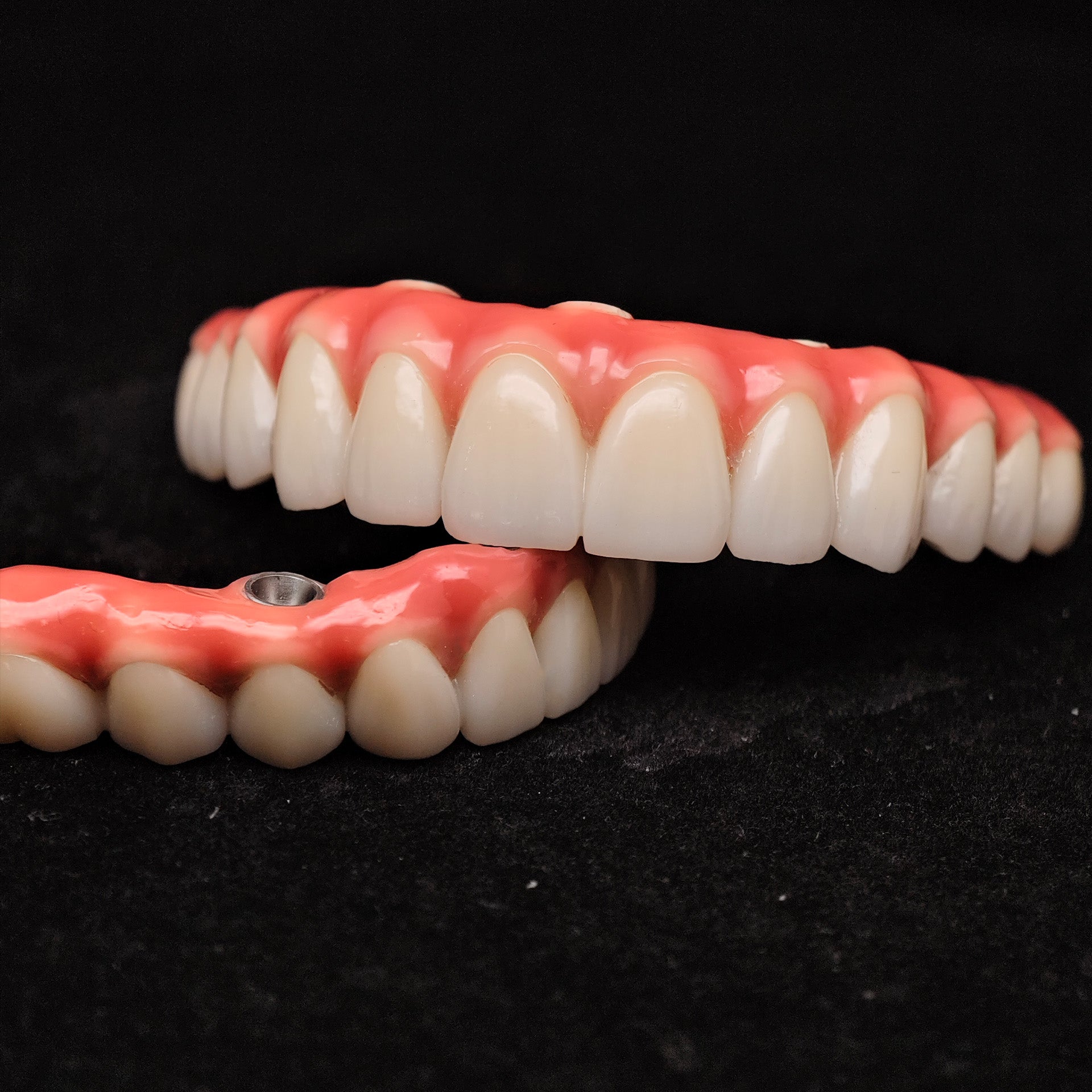 Zirconia-Enamel Hybrid Malo Bridge
