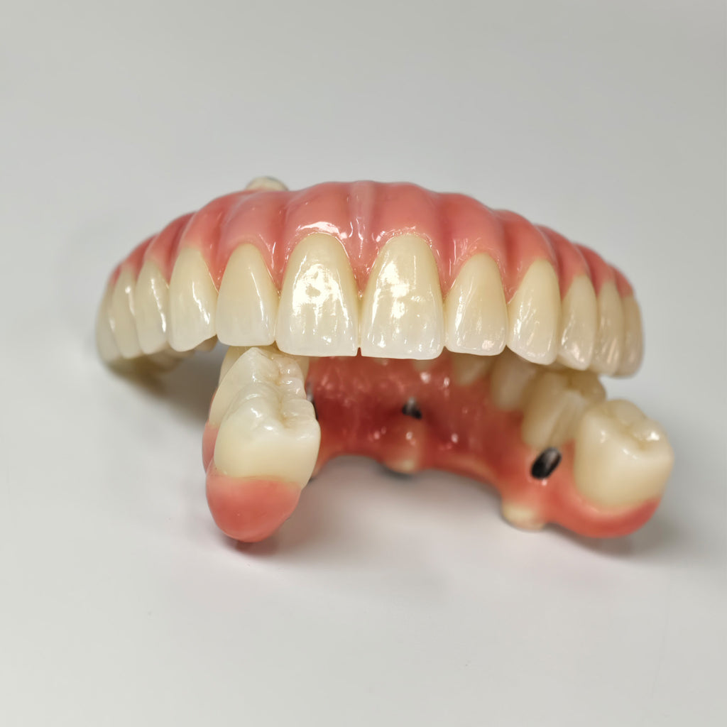 Zirconia-Enamel Hybrid Malo Bridge