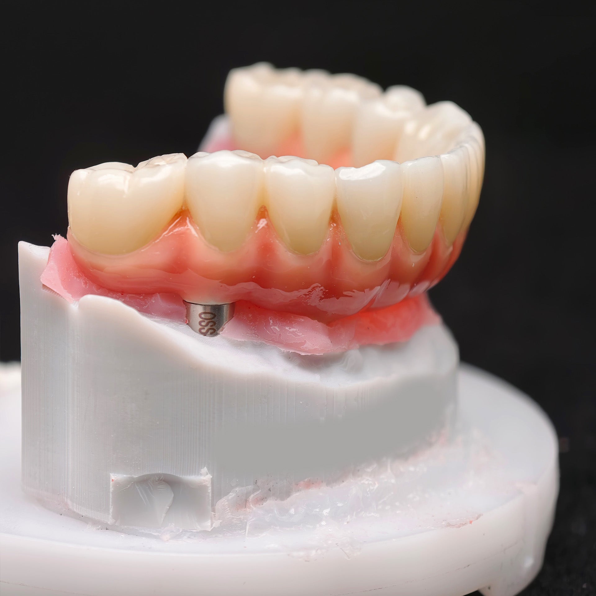 Zirconia-Enamel Hybrid Malo Bridge