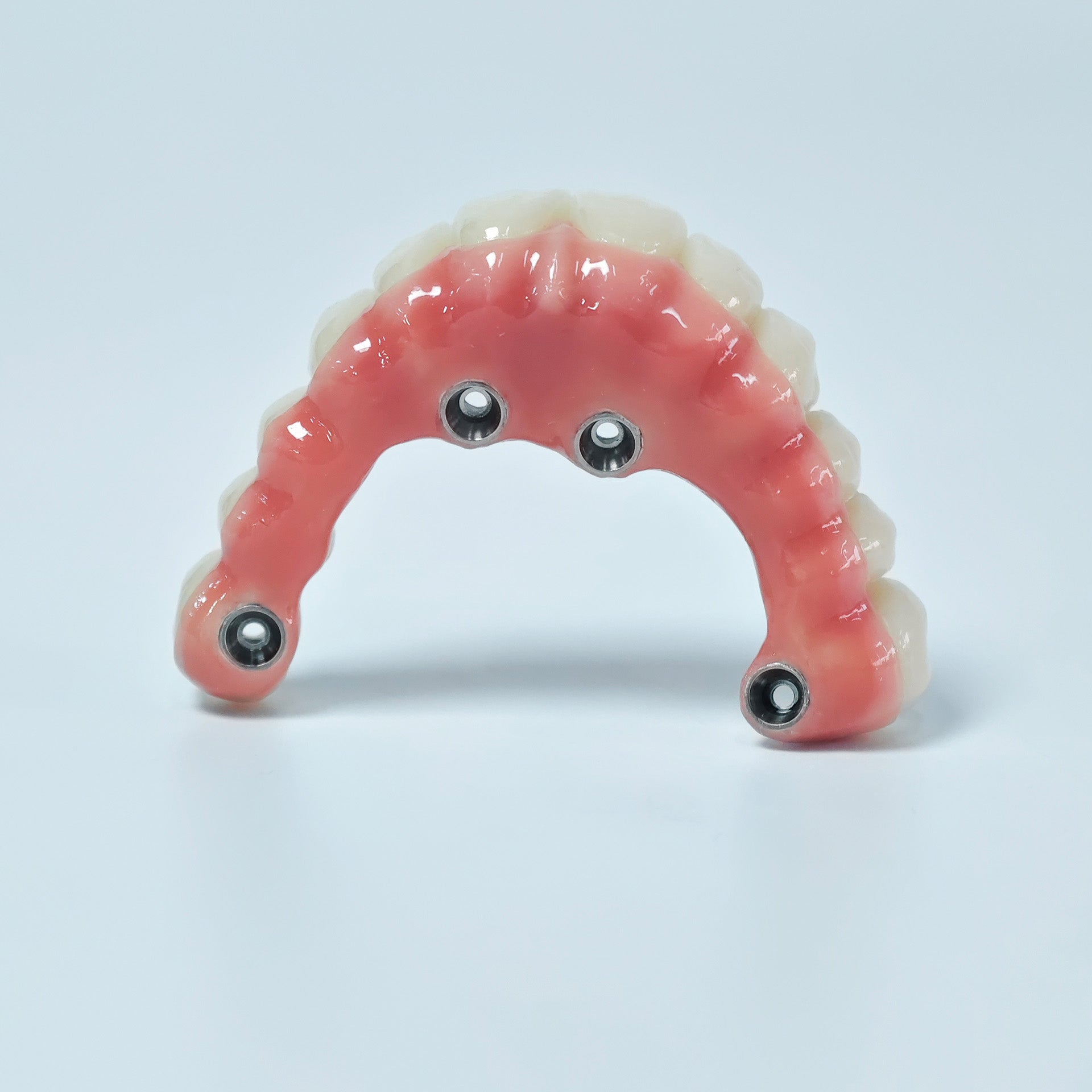Zirconia-Enamel Hybrid Malo Bridge