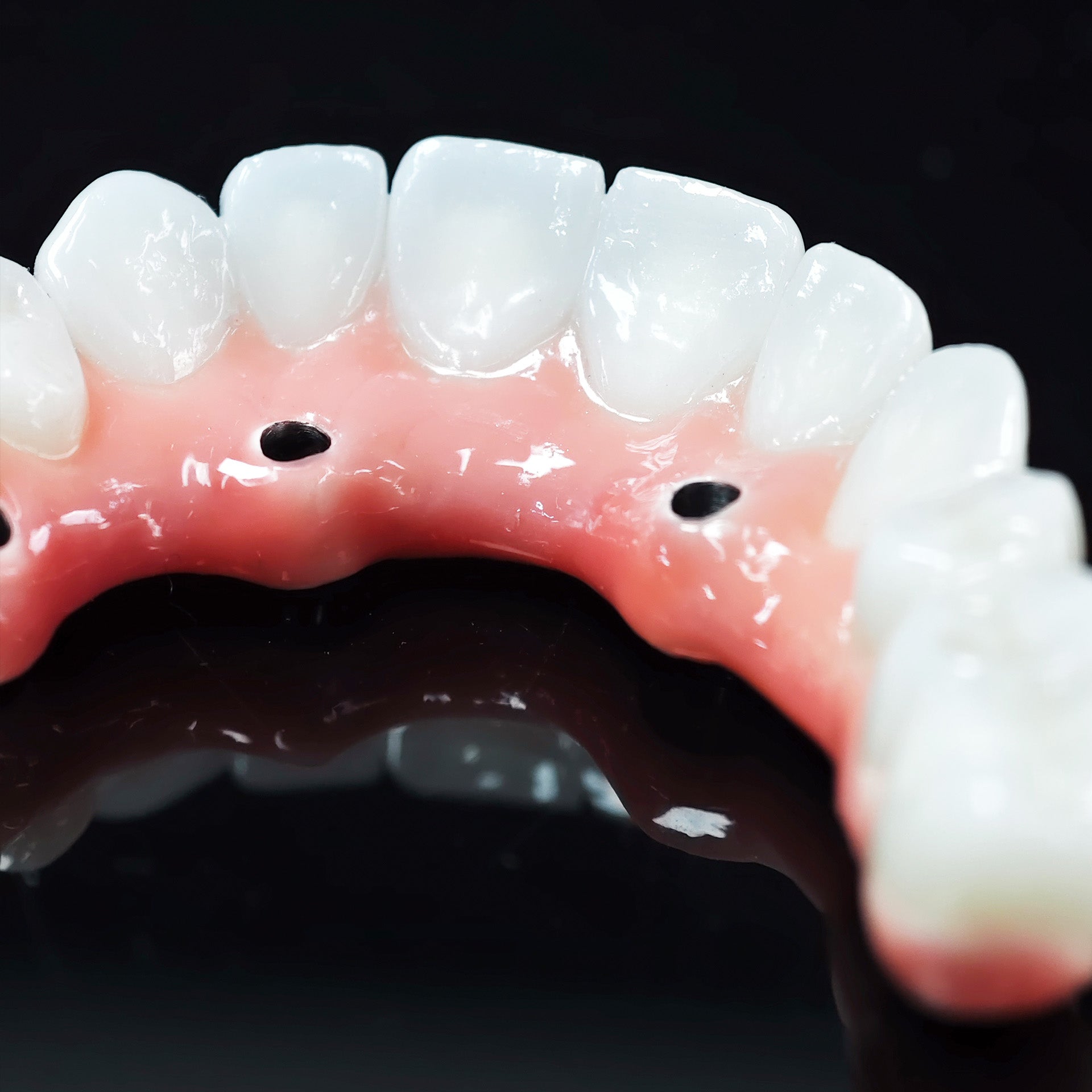 Zirconia-Enamel Hybrid Malo Bridge