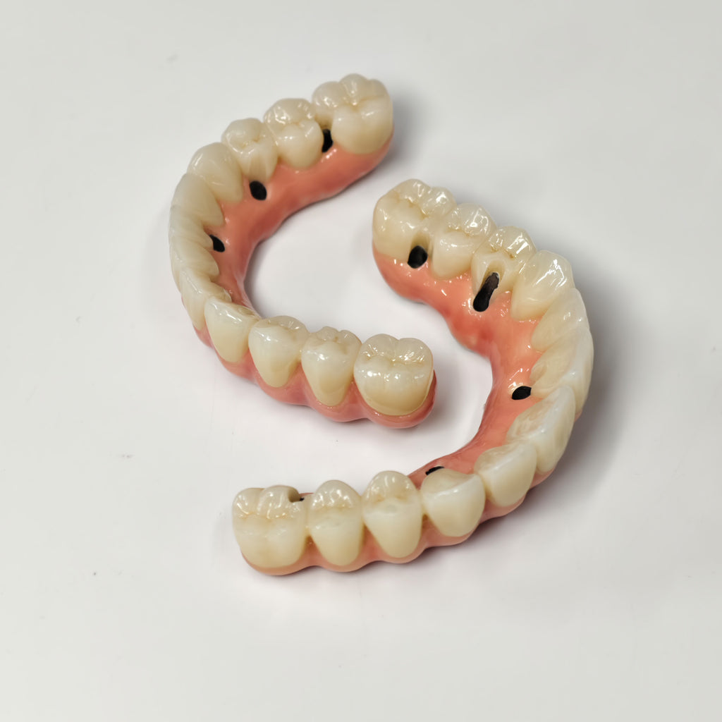 Zirconia-Enamel Hybrid Malo Bridge