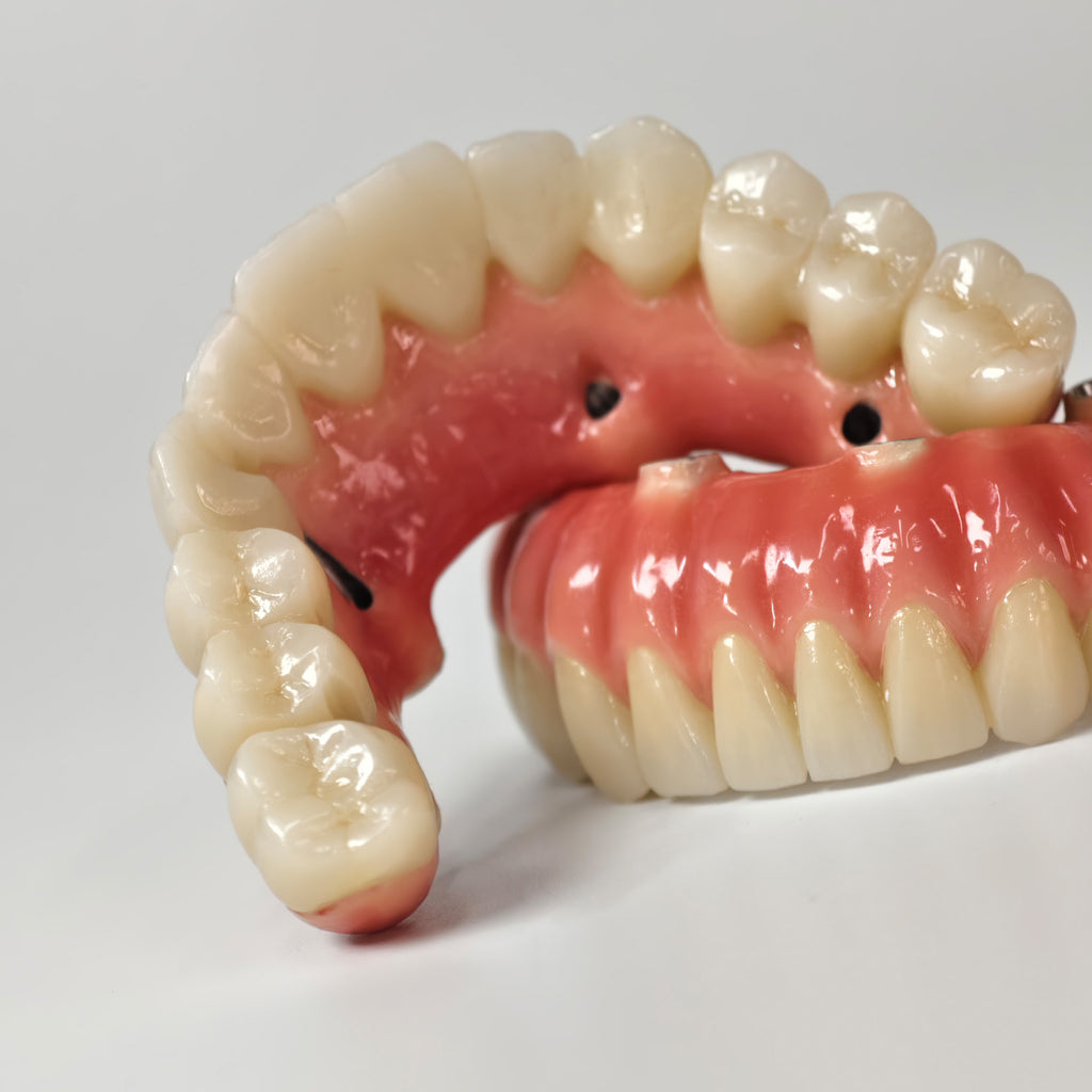 Zirconia-Enamel Hybrid Malo Bridge