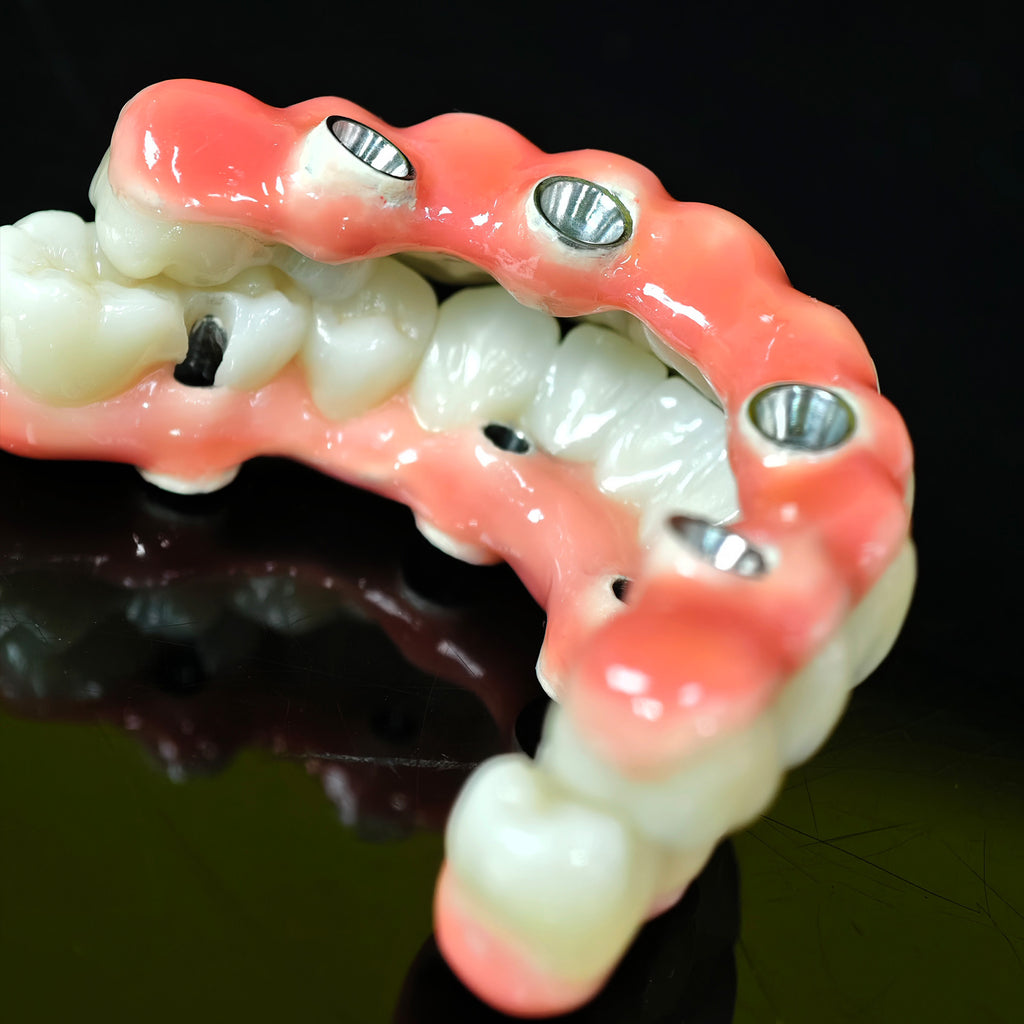 Zirconia-Enamel Hybrid Malo Bridge