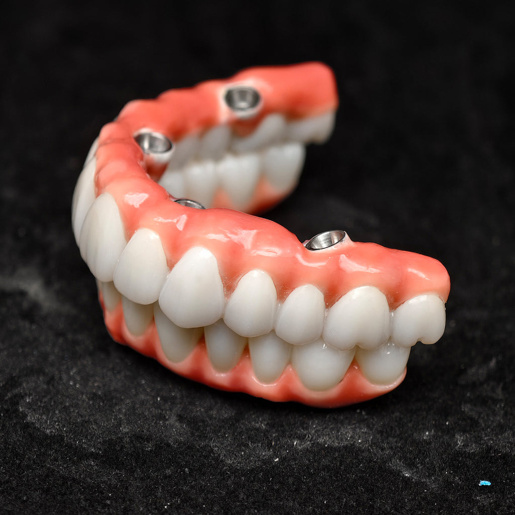 Zirconia-Enamel Hybrid Malo Bridge