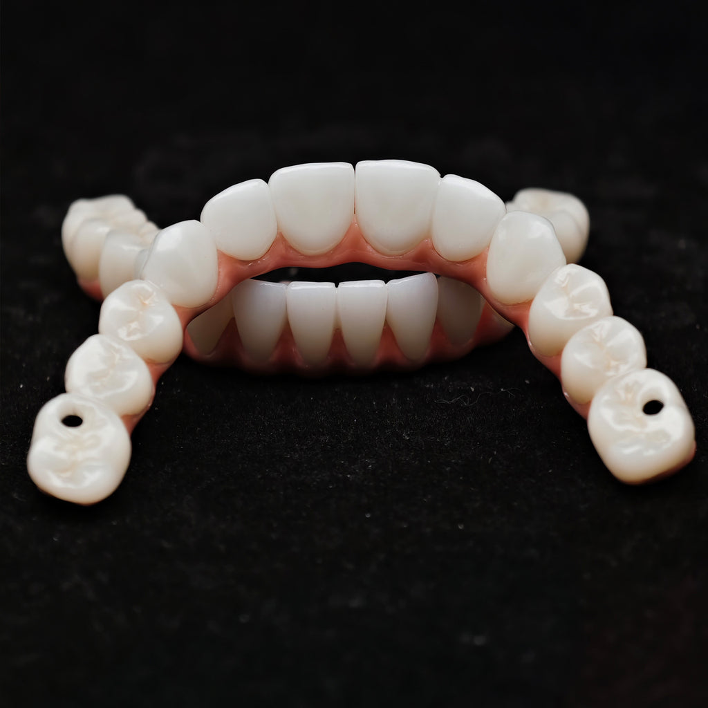 Zirconia-Enamel Hybrid Malo Bridge