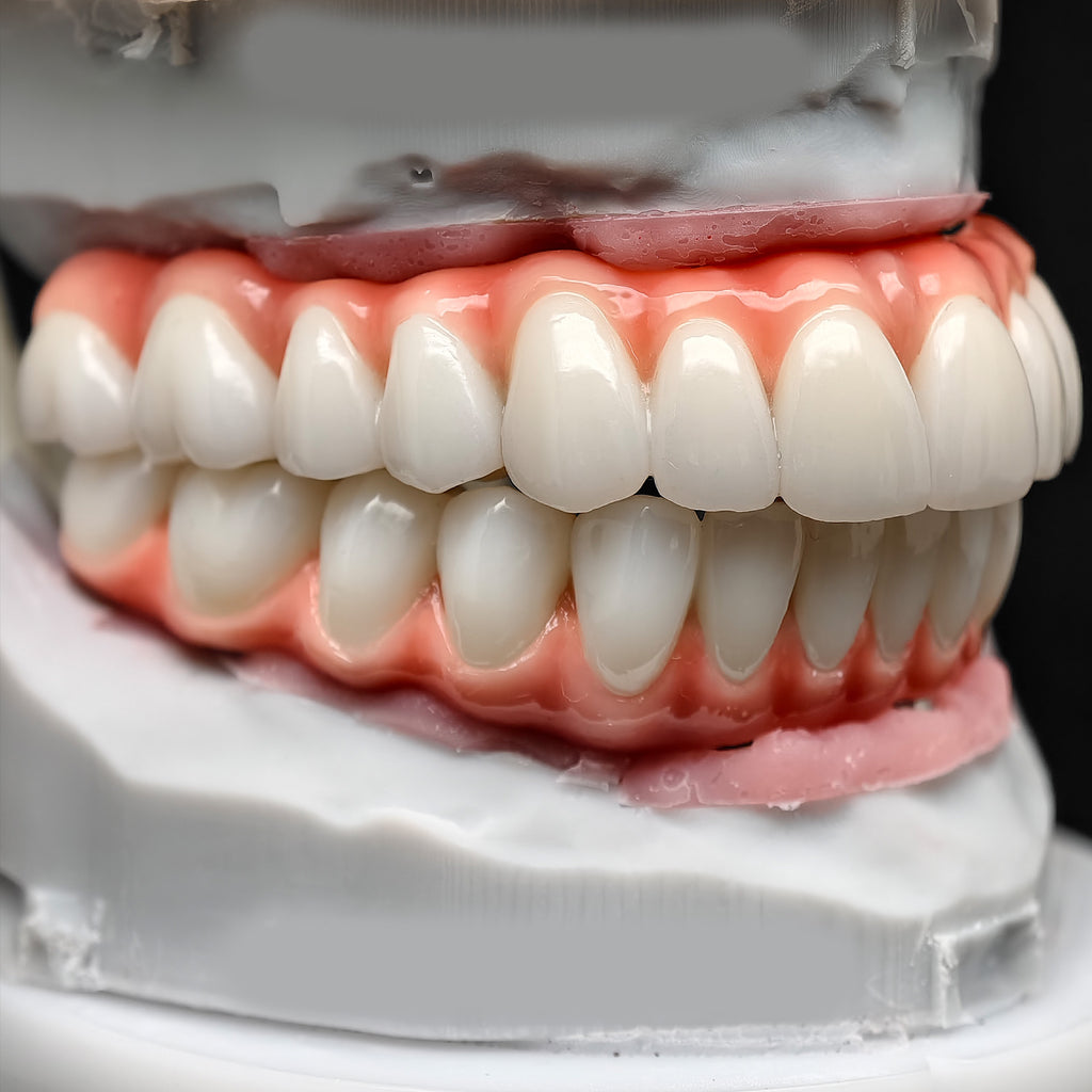 Zirconia-Enamel Hybrid Malo Bridge