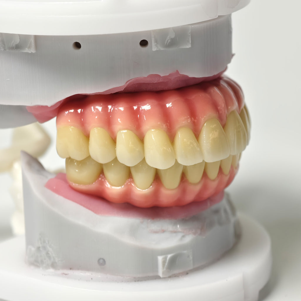 Zirconia-Enamel Hybrid Malo Bridge