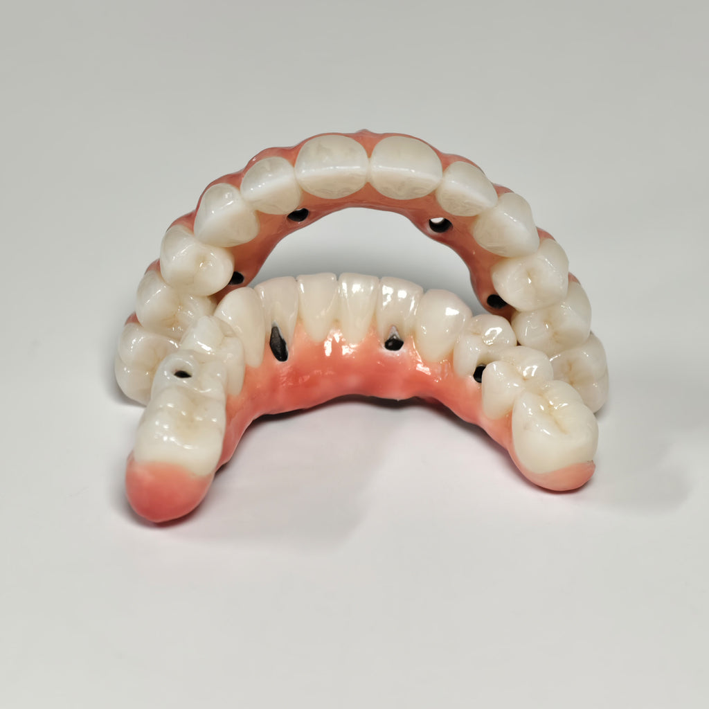 Zirconia-Enamel Hybrid Malo Bridge