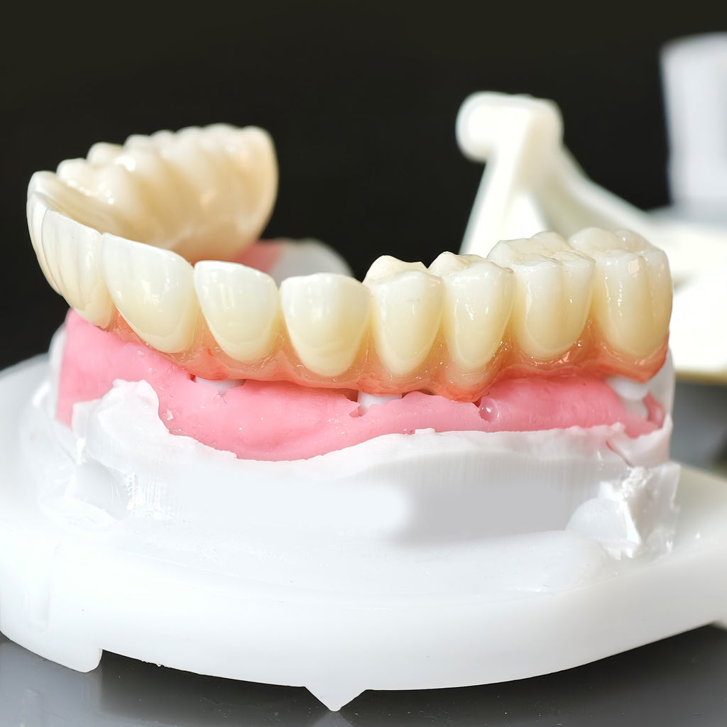 Zirconia Bridge With Cement Retained