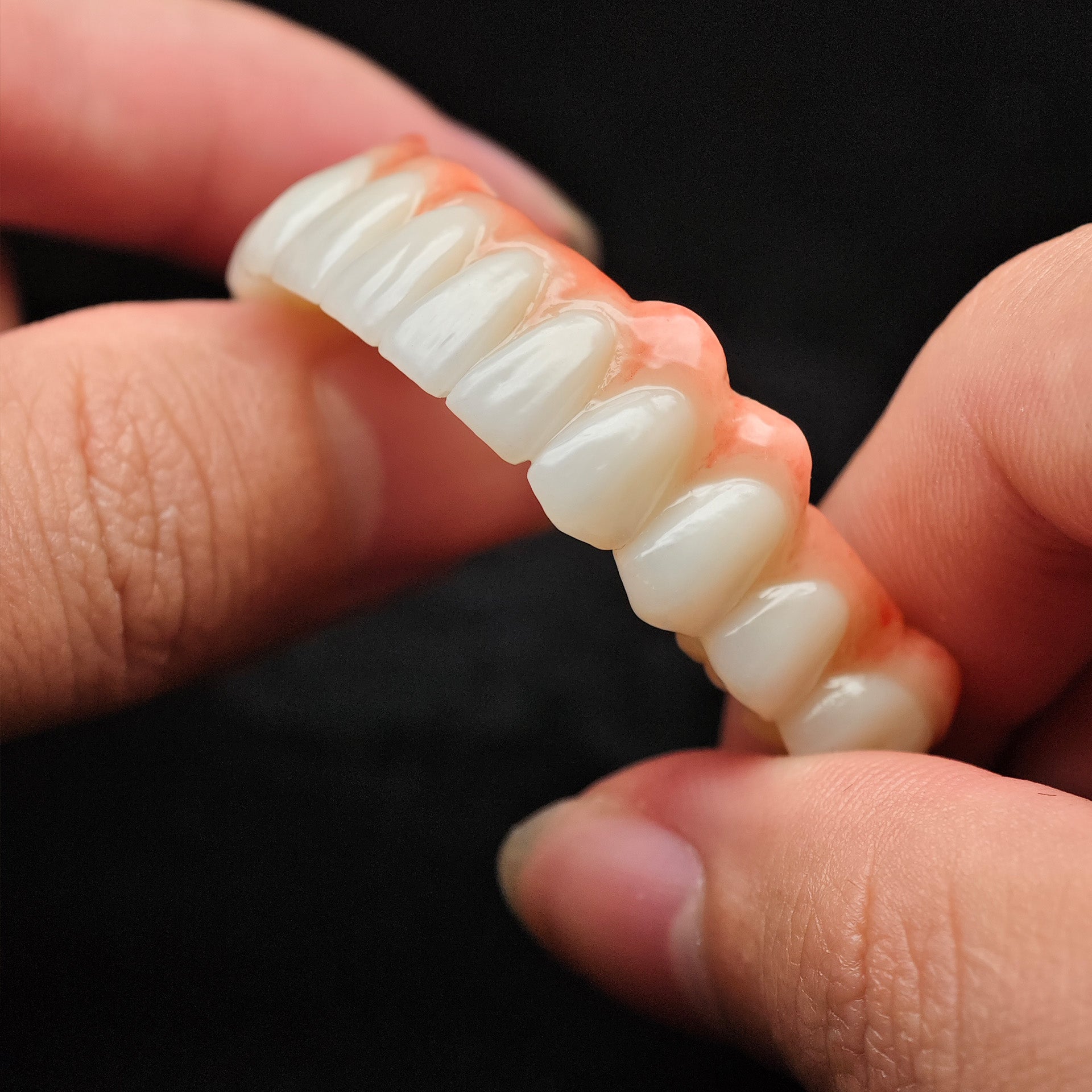 Zirconia Bridge With Cement Retained