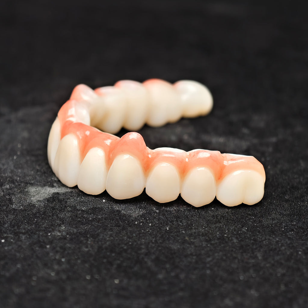 Zirconia Bridge With Cement Retained