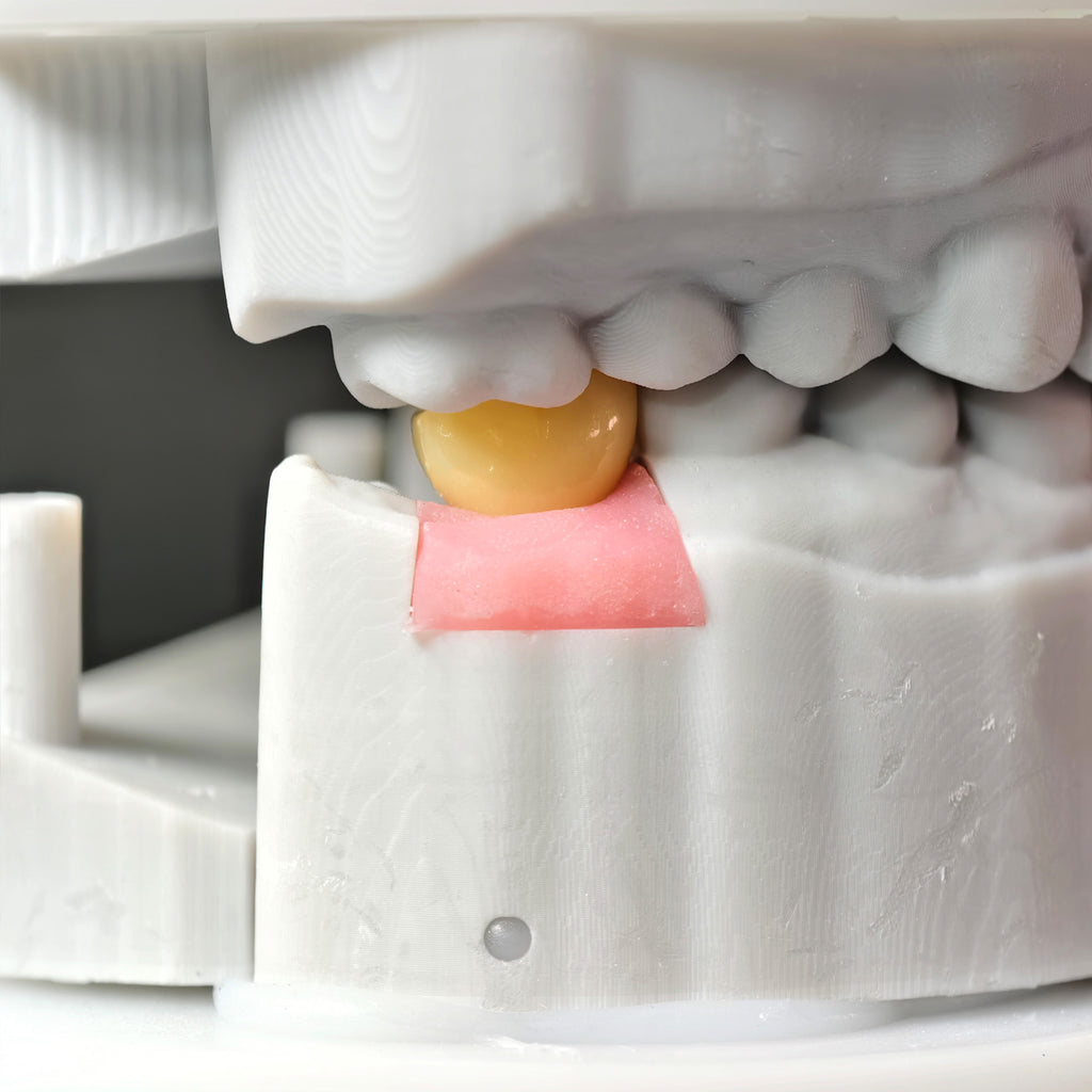 Zirconia Crowns With Screw Retained
