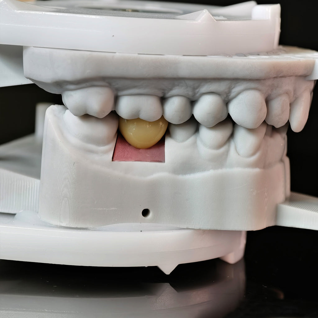 Zirconia Crowns With Screw Retained