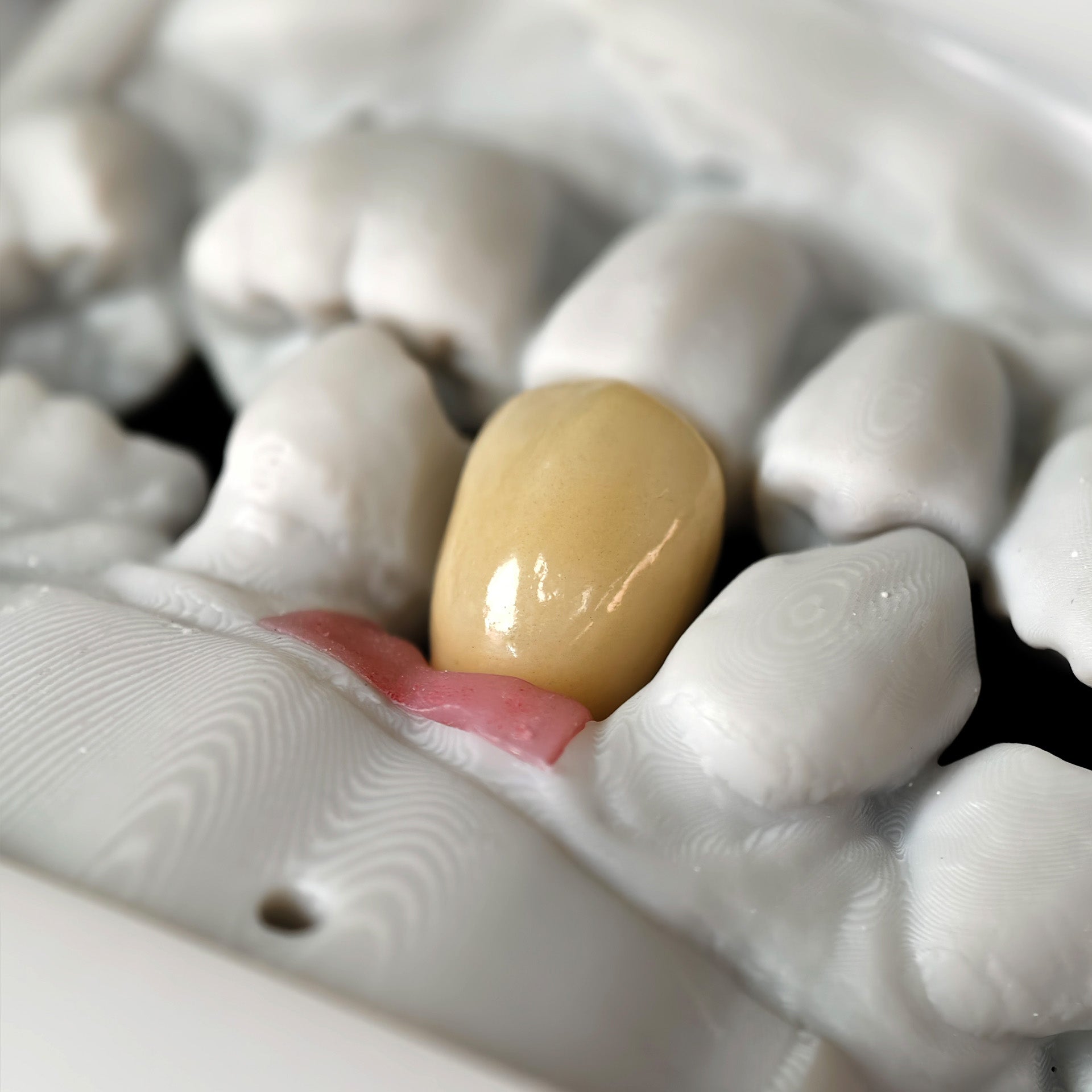 Zirconia Crown With Screw Retained
