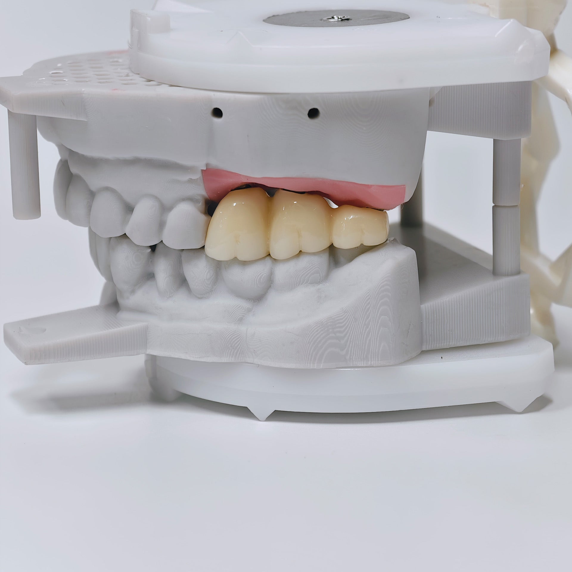 Zirconia Implant Bridge Screwmentable Dental Crown