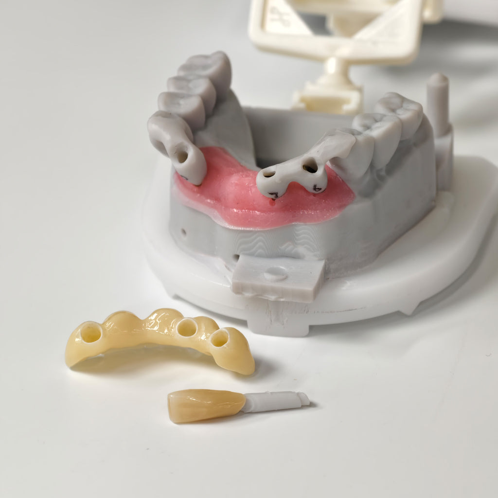 Zirconia Implant Bridge Screwmentable Dental Crown