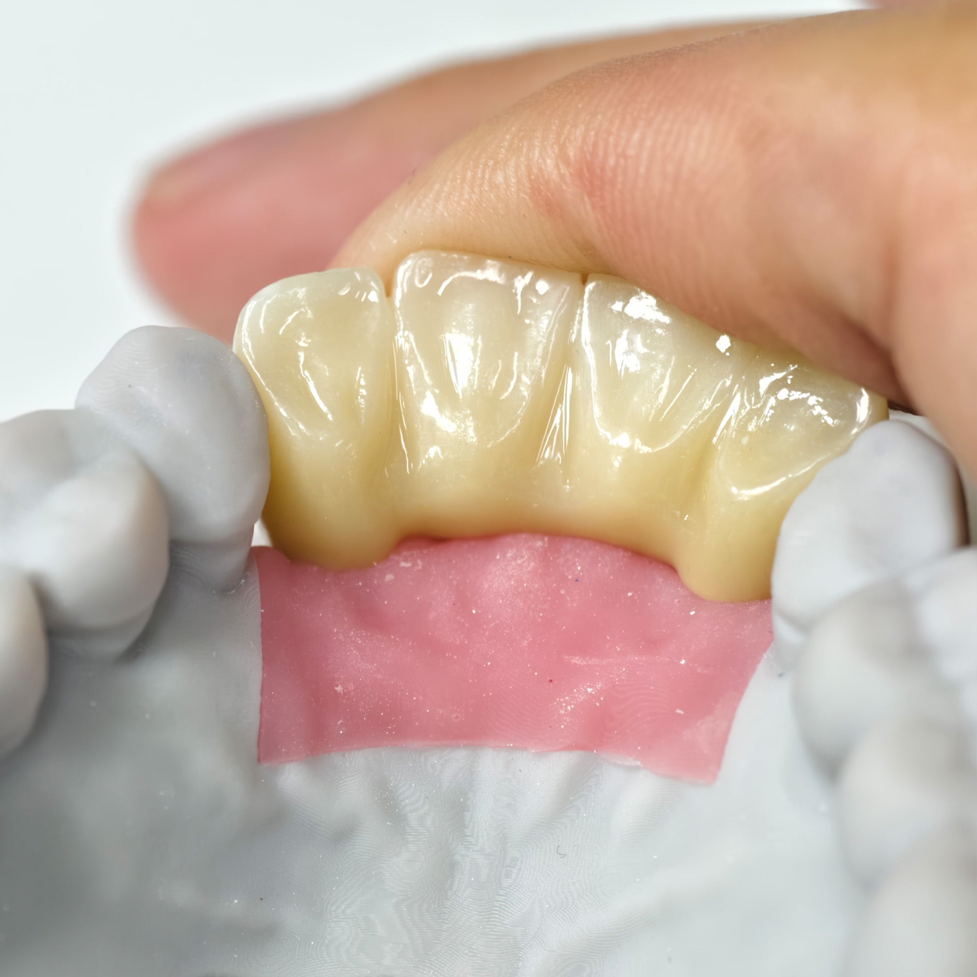Zirconia Implant Bridge Screwmentable Dental Crown