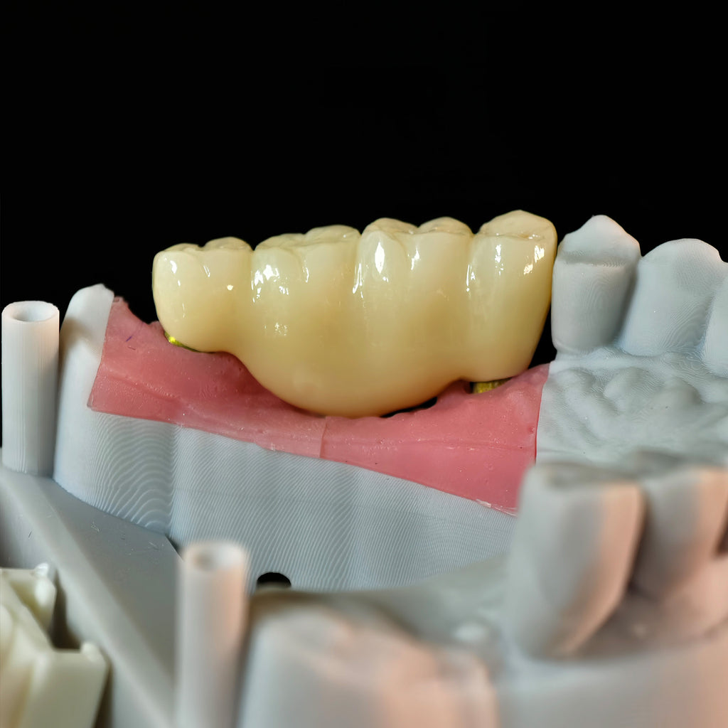 Zirconia Implant Bridge Screwmentable Dental Crown
