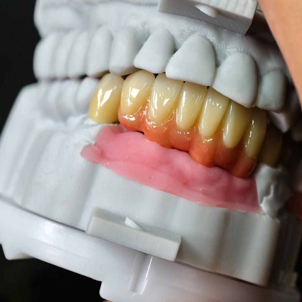 Zirconia Implant Bridge Screwmentable Dental Crown