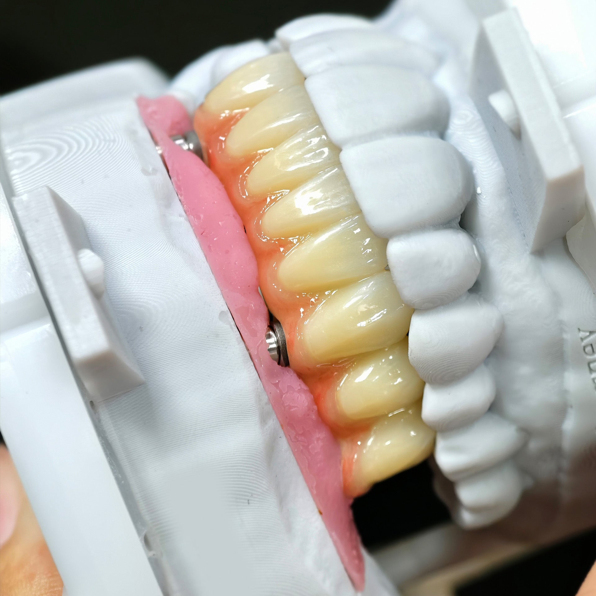 Zirconia Implant Bridge Screwmentable Dental Crown