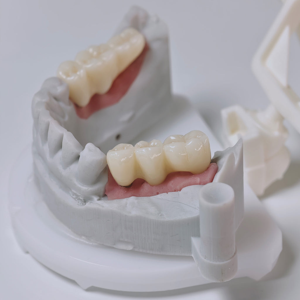 Zirconia Implant Bridges Screwmentable Dental Crown