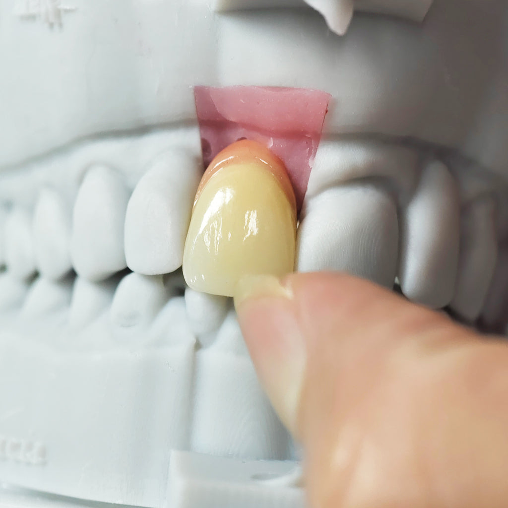 Zirconia Implant Crown Screwmentable Dental Crown
