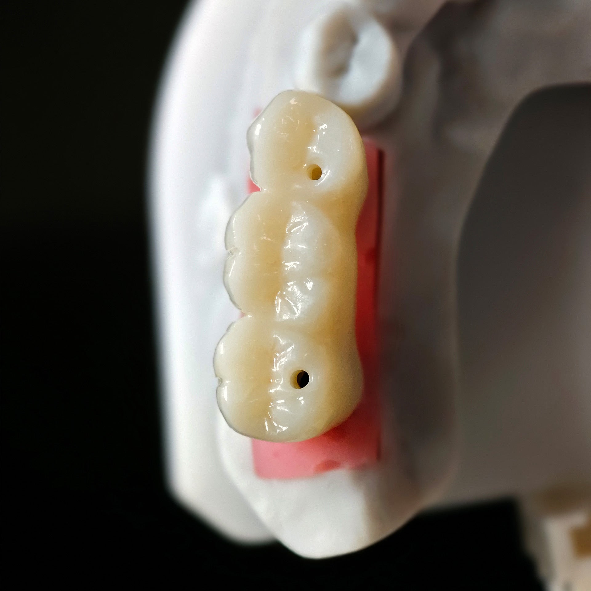 Zirconia Implant Crown Screwmentable Dental Crown