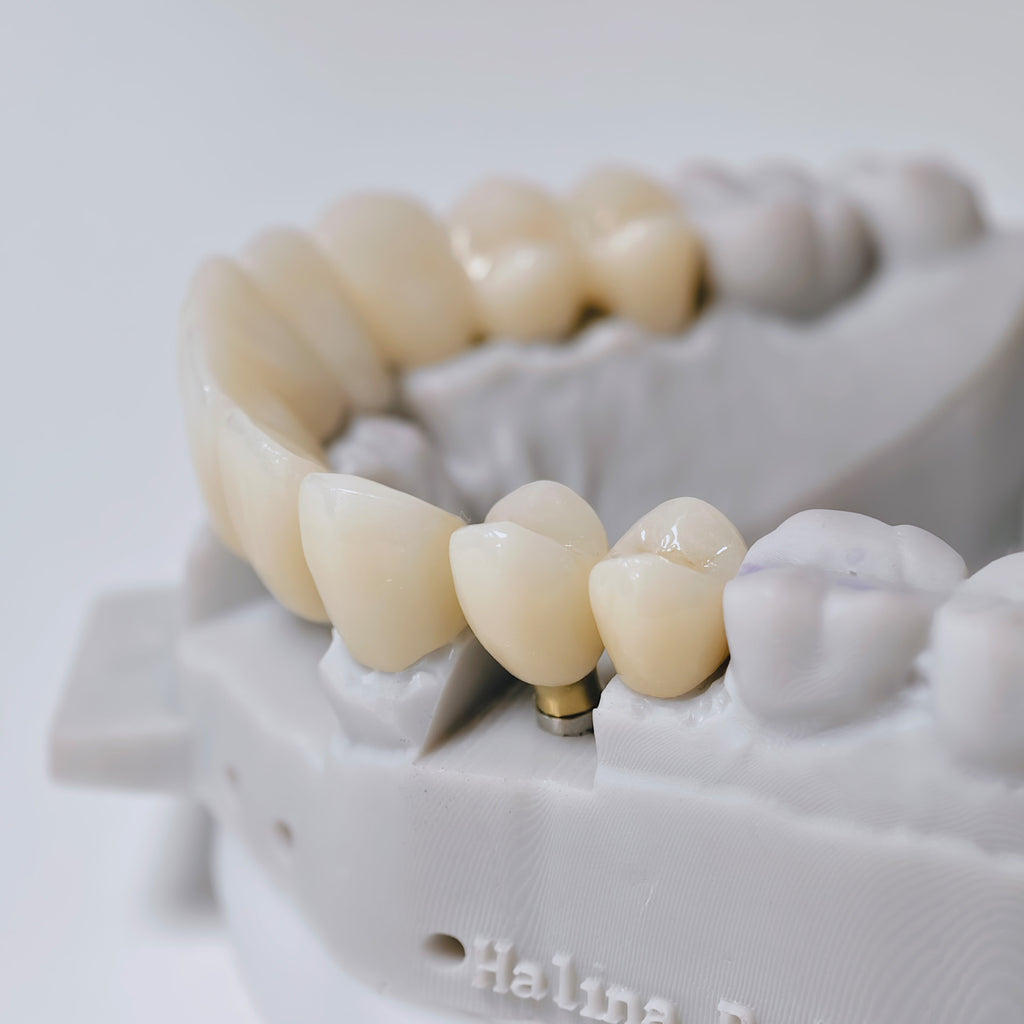 Zirconia Implant Crown And Bridge Screwmentable Dental Crown