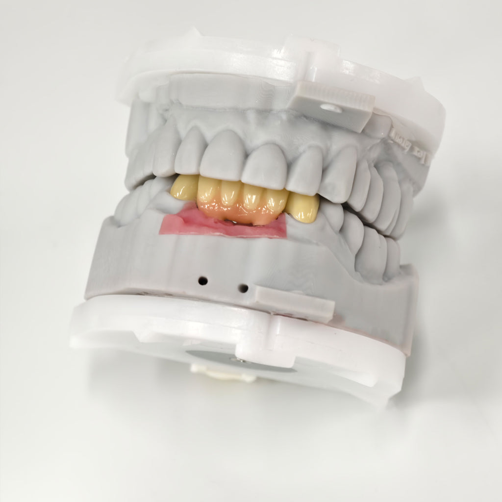 Zirconia Implant Crown And Bridge Screwmentable Dental Crown