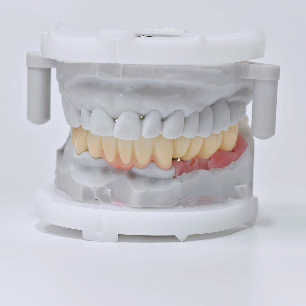Zirconia Implant Crown And Bridges Screwmentable Dental Crown