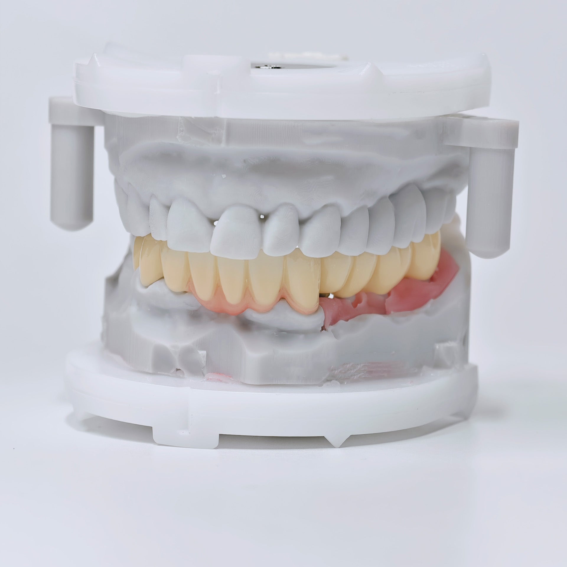 Zirconia Implant Crown And Bridges Screwmentable Dental Crown