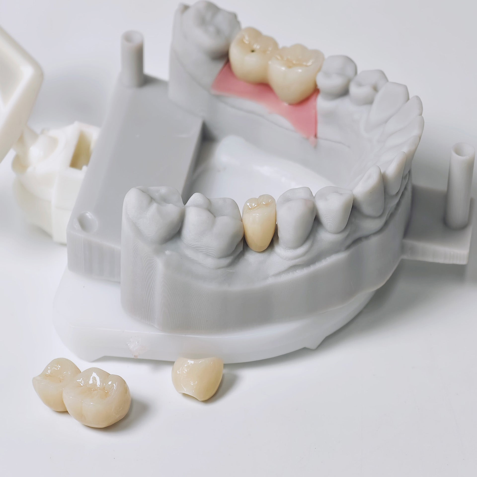 Zirconia Implant Crowns And Bridges Screwmentable Dental Crown