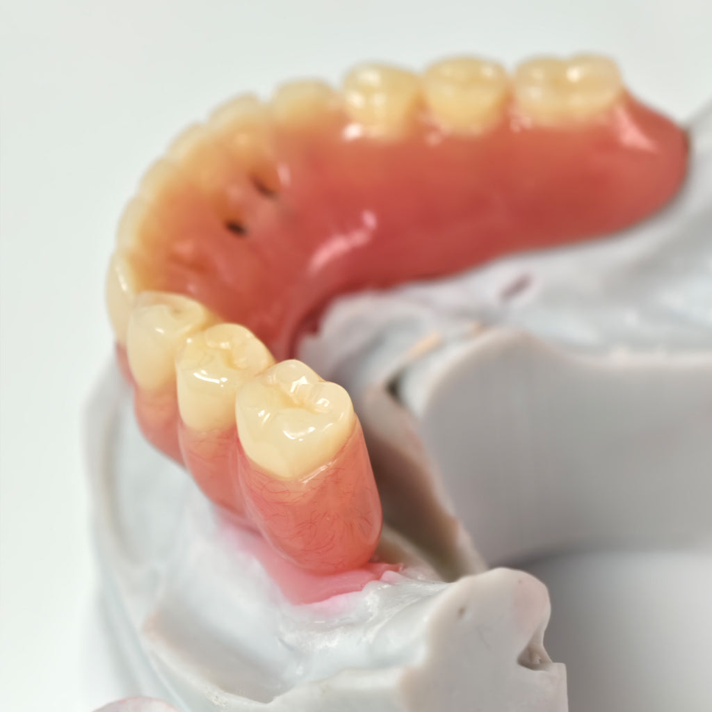 Acrylic Denture With Ti-Bar And Screw Retained