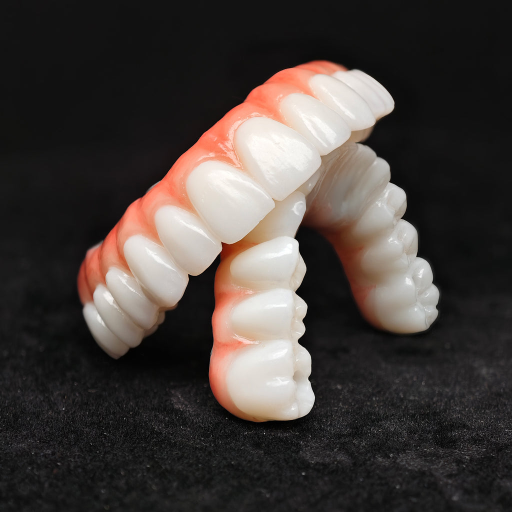 All On 4 Zirconia Bridge With Ti-Base Screw Retained Trying For Full Arch Restoration