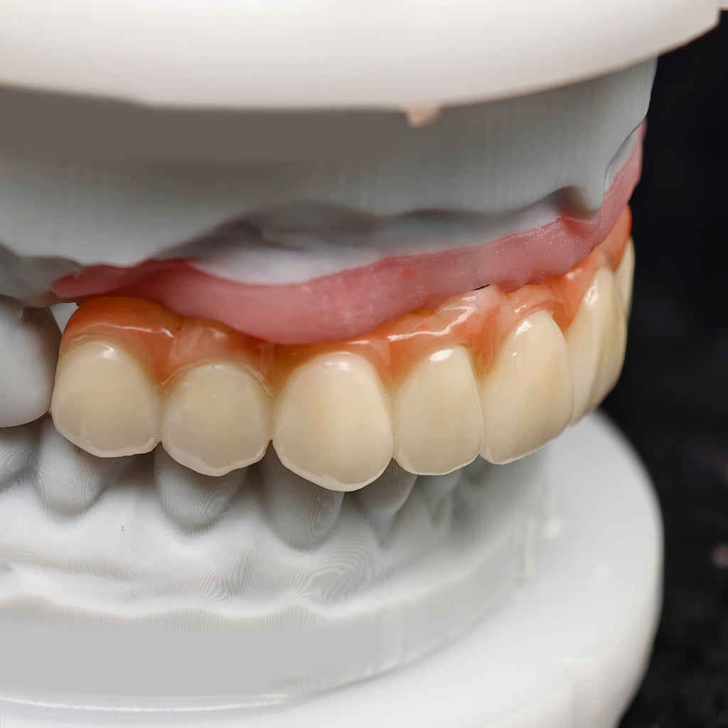All On 4 Zirconia Bridge With Ti-Base Screw Retained Trying For Full Arch Restoration