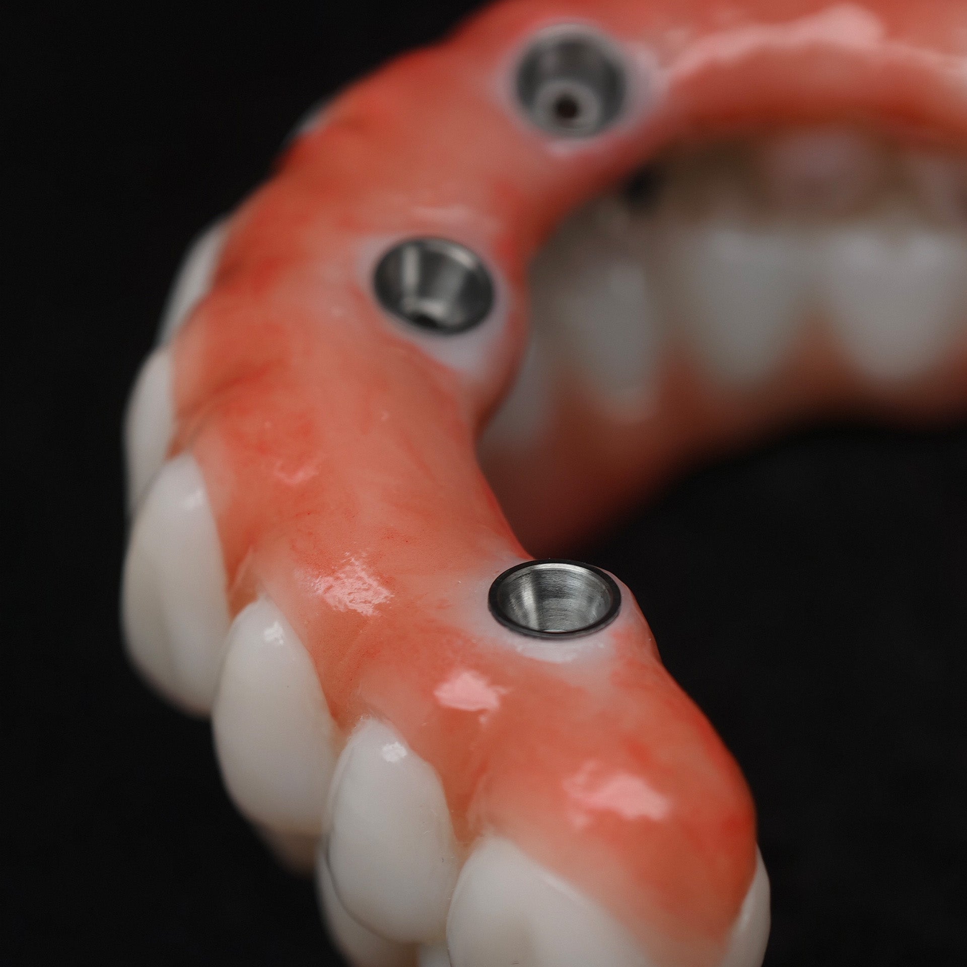 All On 4 Zirconia Bridge With Ti-Base Screw Retained Trying For Full Arch Restoration