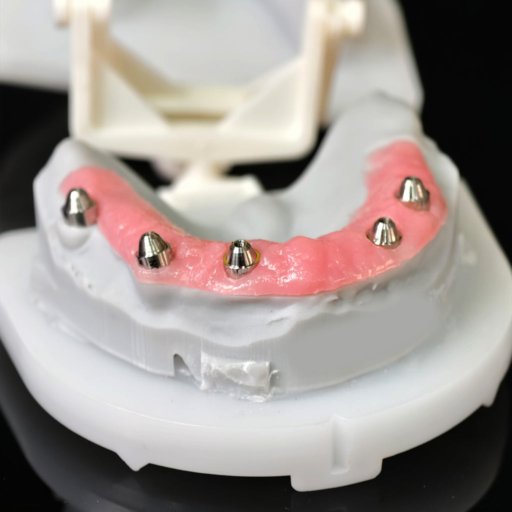 All On 5 Zirconia Bridge With Ti-Base Screw Retained Trying For Full Arch Restoration