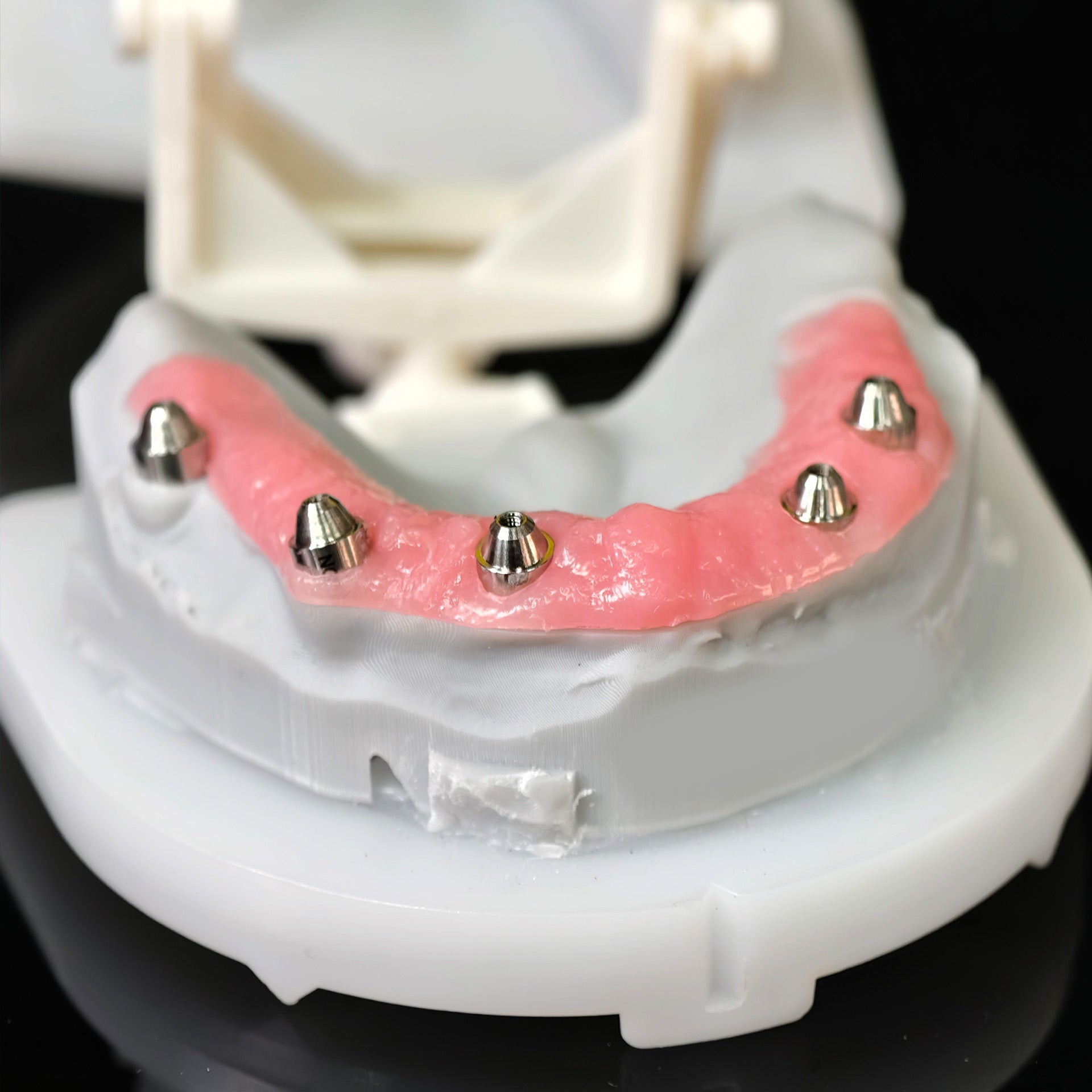 All On 5 Zirconia Bridge With Ti-Base Screw Retained Trying For Full Arch Restoration