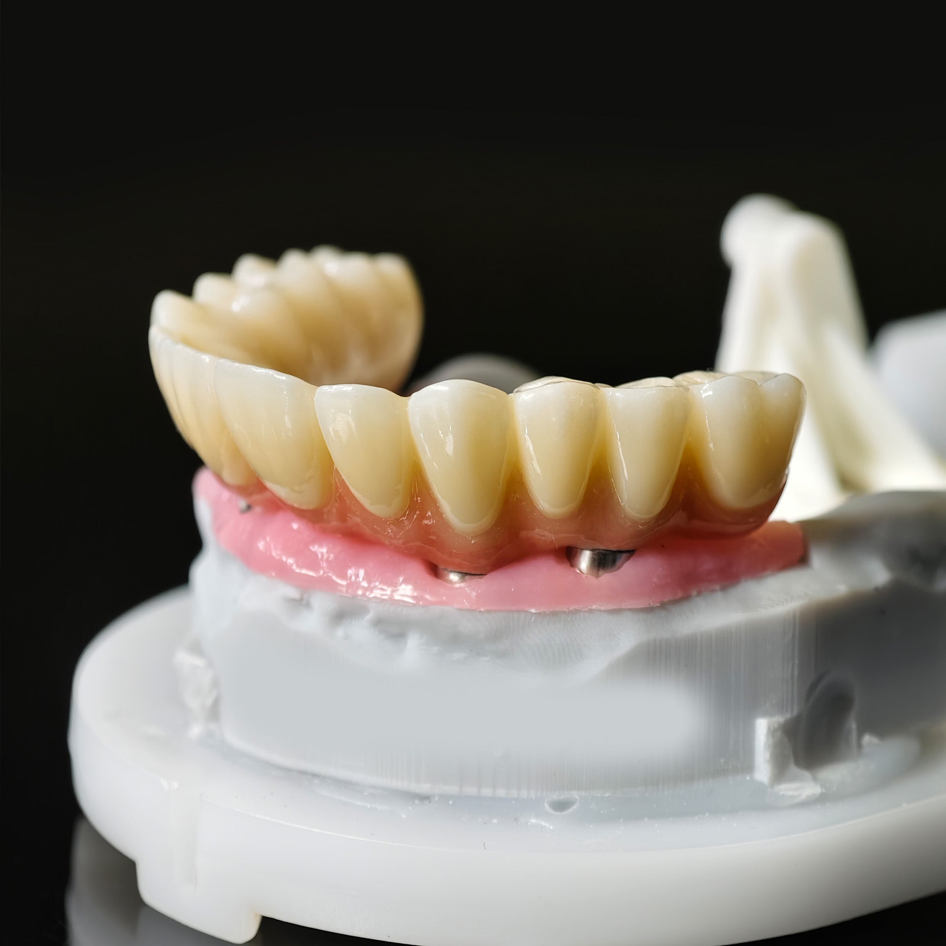 All On 5 Zirconia Bridge With Ti-Base Screw Retained Trying For Full Arch Restoration