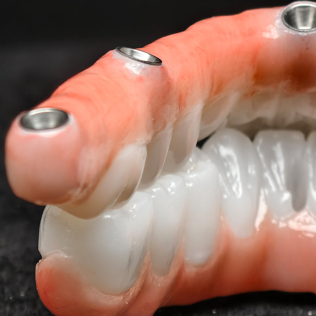 All On 5 Zirconia Bridge With Ti-Base Screw Retained Trying For Full Arch Restoration