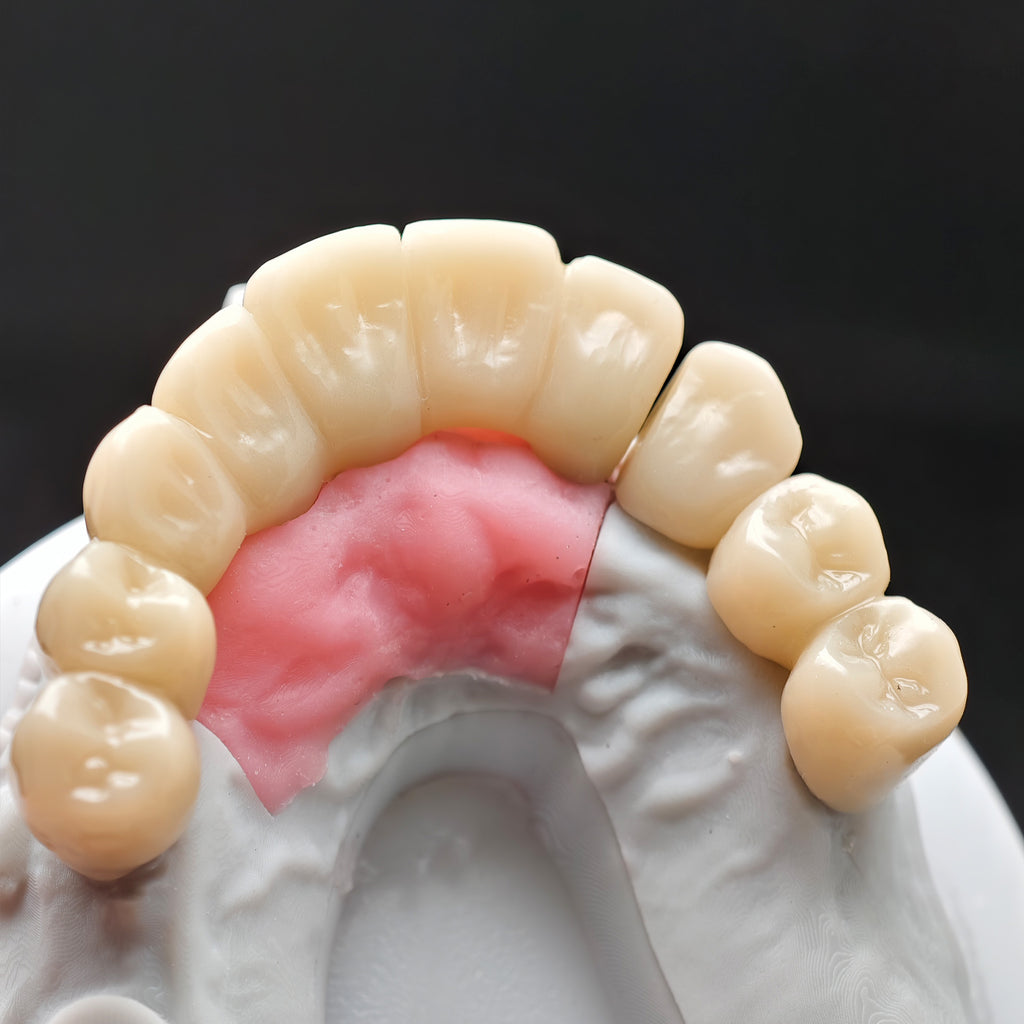Custom Abutment With Zirconia Crown And Bridge
