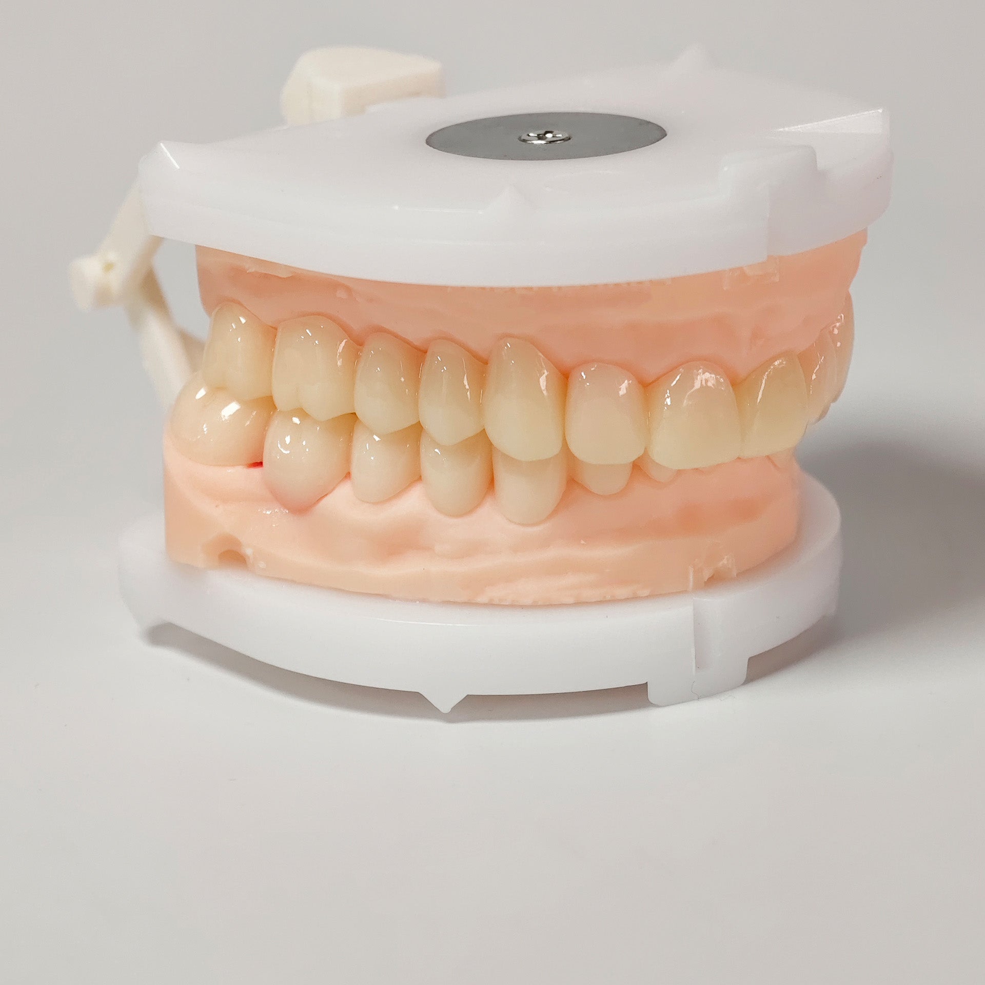 Full-Mouth Segmented PMMA Bridge With Cement Retained