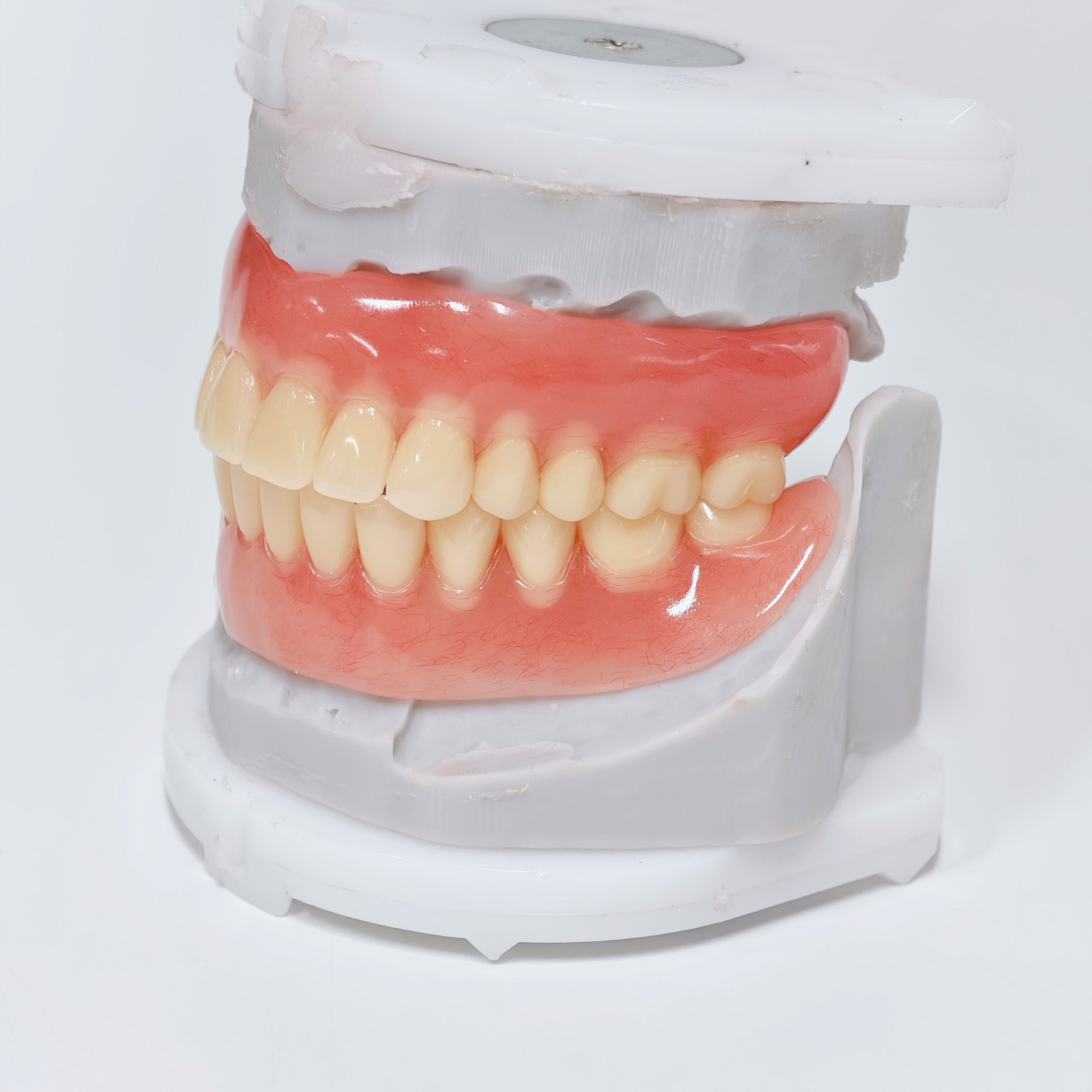 Full-Mouth Acrylic Denture