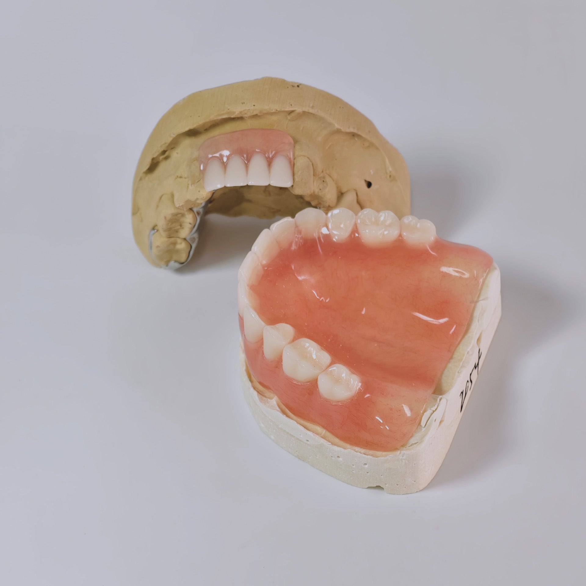 Full-Mouth Acrylic Denture