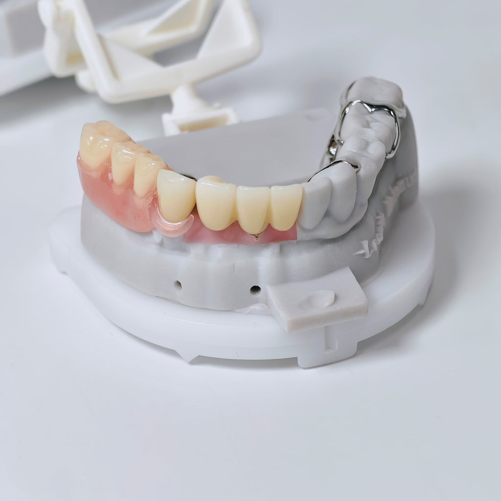 Full-Zirconia Crown And Bridge With Cement Retained And Co-Cr Frame Partial Denture