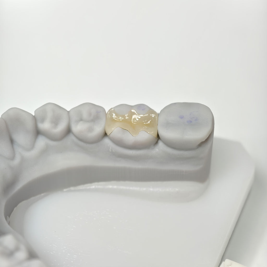 Full-Zirconia Laying