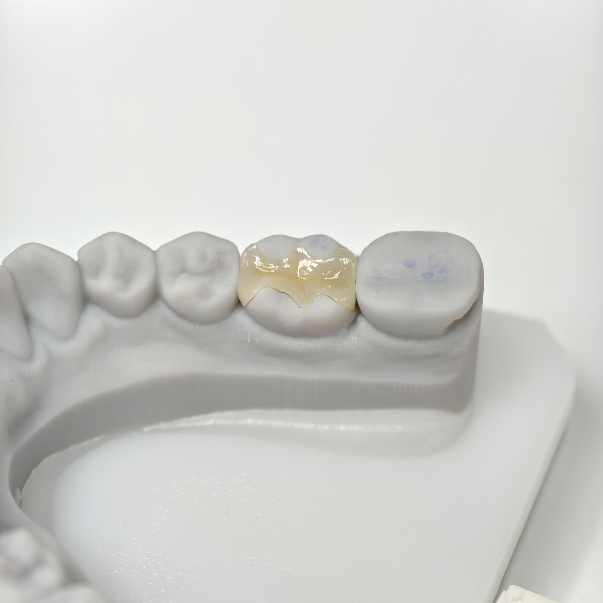 Full-Zirconia Laying