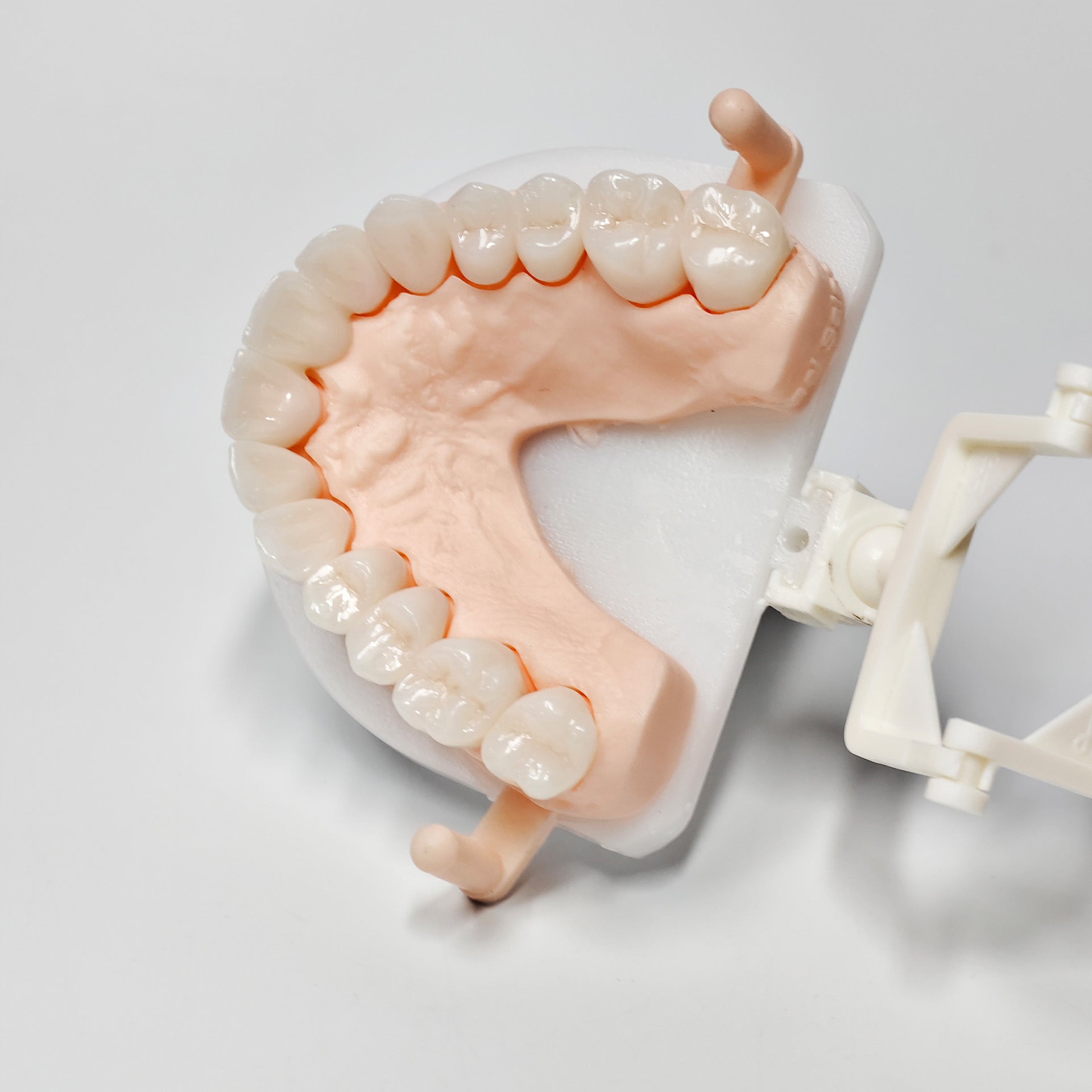 Full-Zriconia Crowns With Cement-Retained