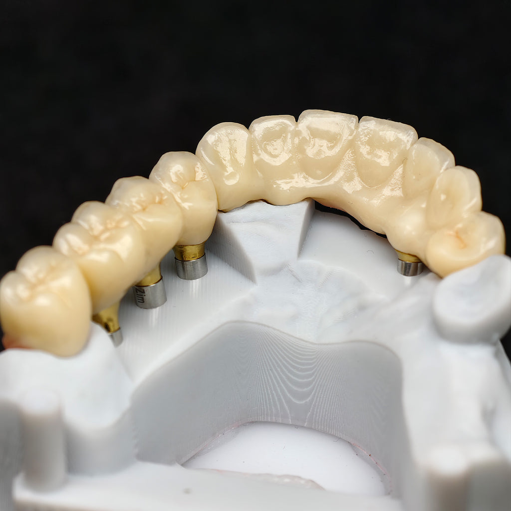 Zirconia Crown And Birdge With Cemented And Implant Seating Guide